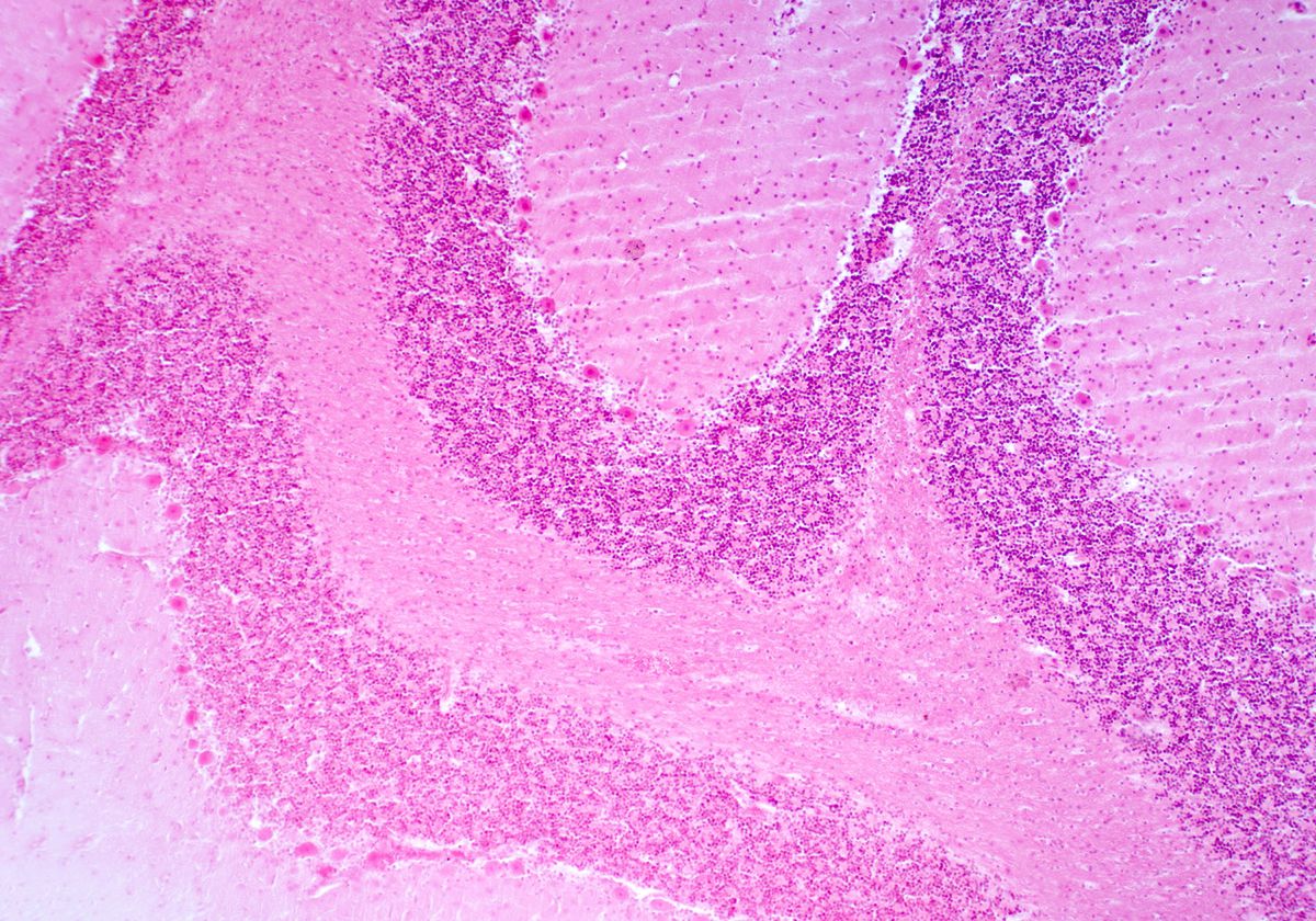 Histology cross section of cerebellum tissue stained in pink and viewed under a light microscope.